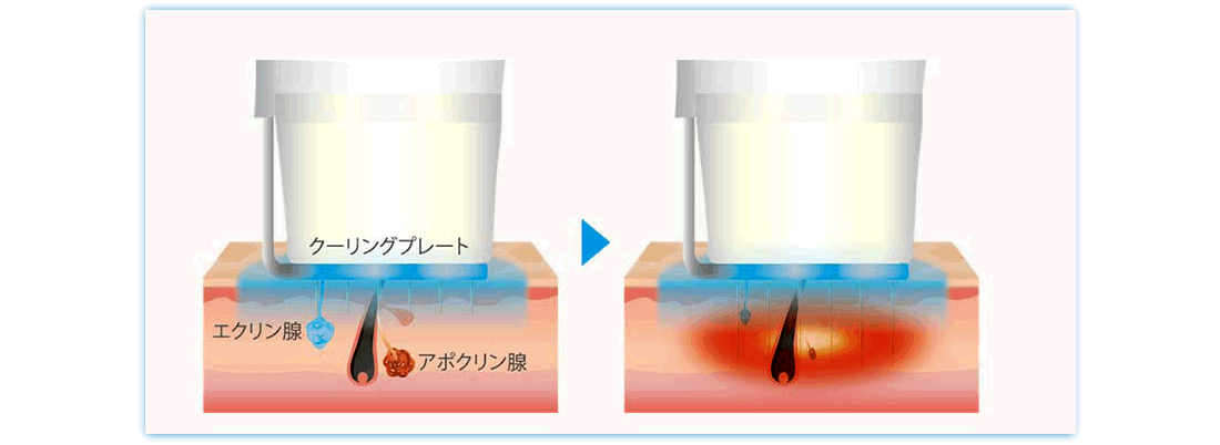 ビューホットの仕組みの図解