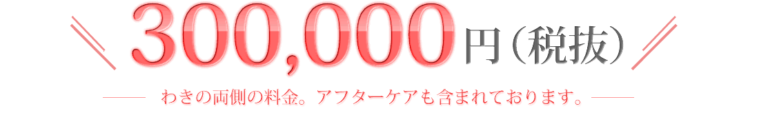 300,000円（税抜）