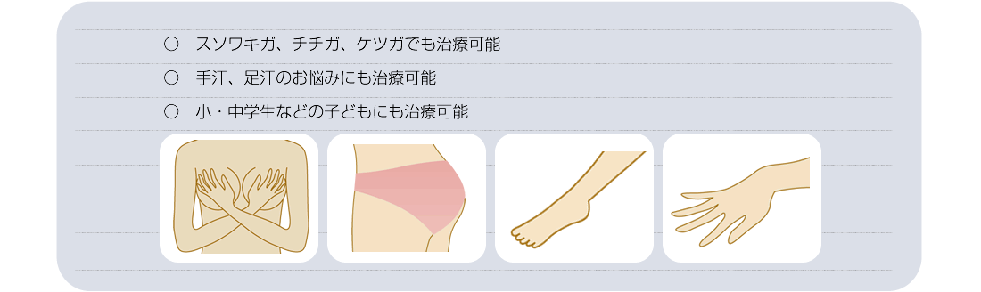 施術可能部位イメージ画像