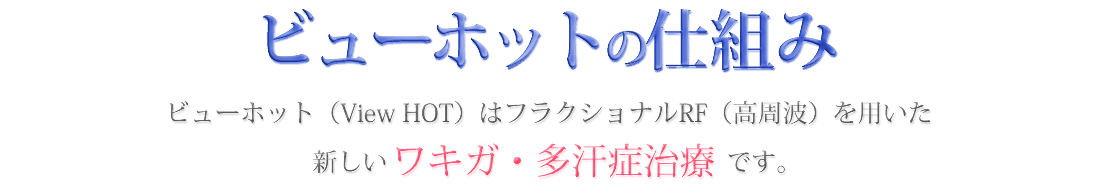 ビューホットの仕組み